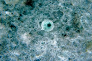 Entamoeba Histolytica [Photo credit: CDC Public Health Image Library]
