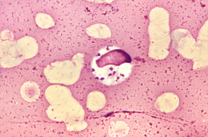 Leishmania [Photo credit: CDC Public Health Image Library]