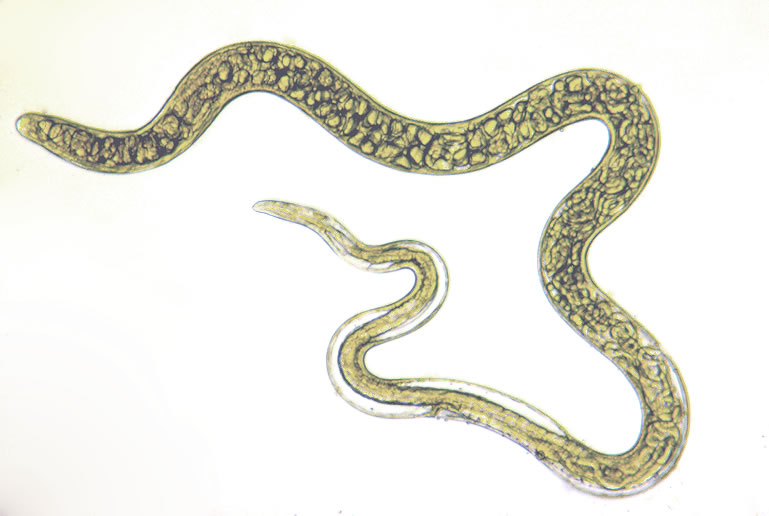 Trichinella spiralis